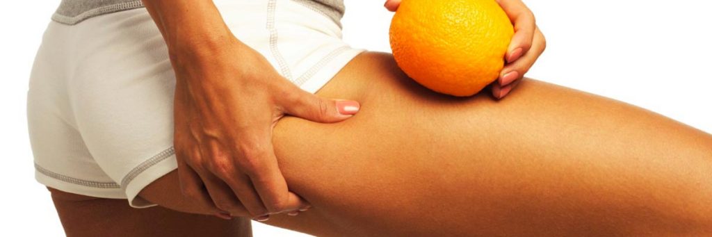 7 FAUX MYTHES SUR LA CELLULITE