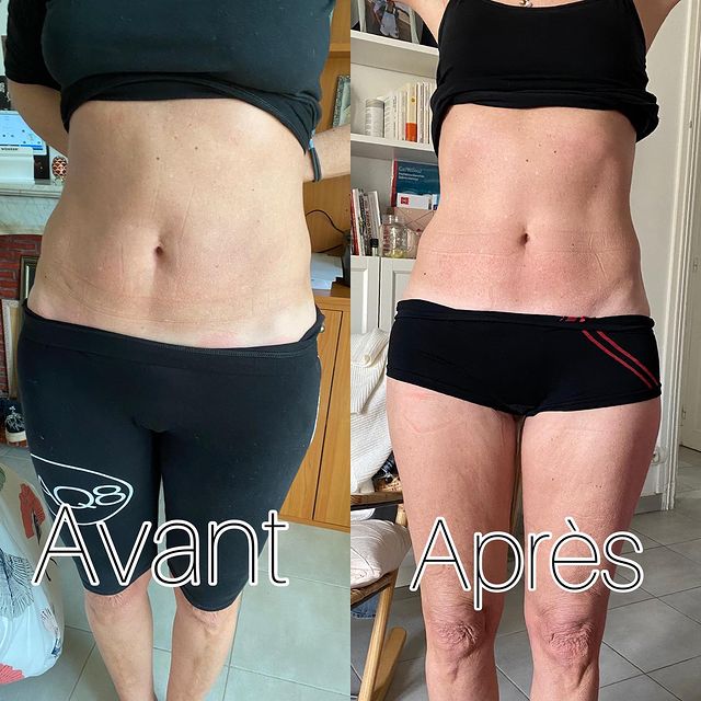 Testimonial protocoles d'amincissement