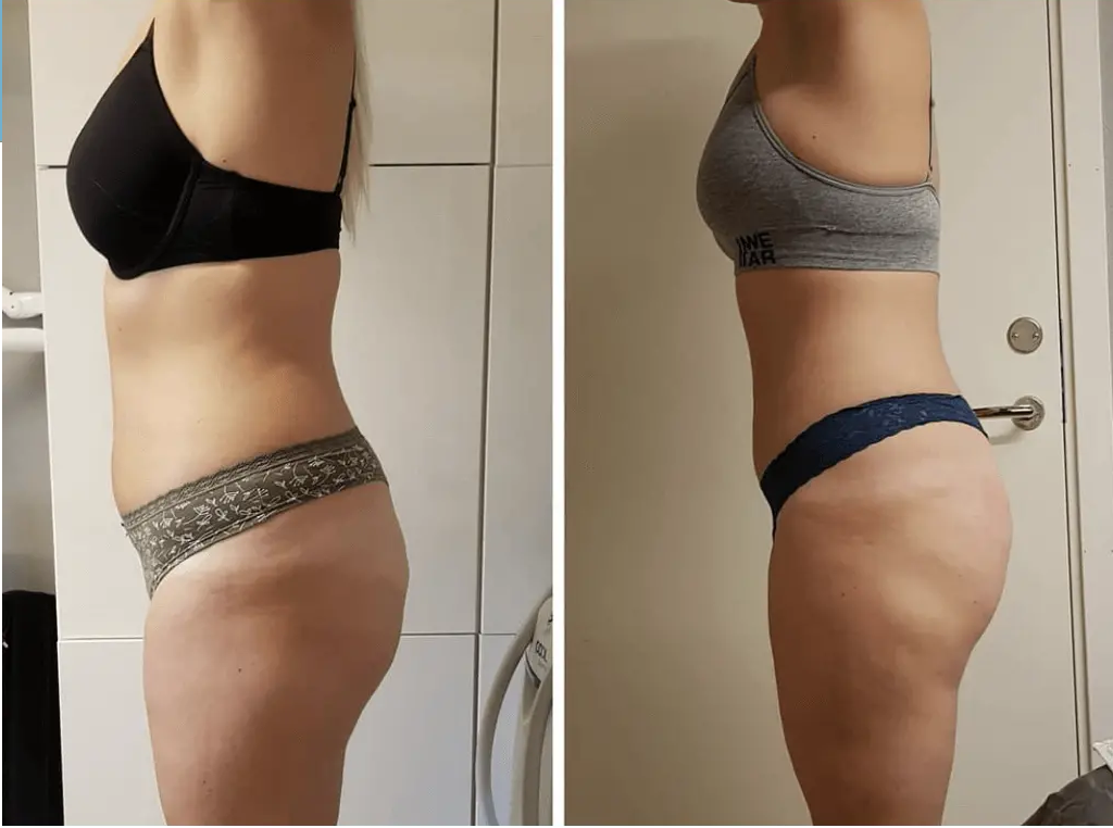 Testimonial protocoles d'amincissement