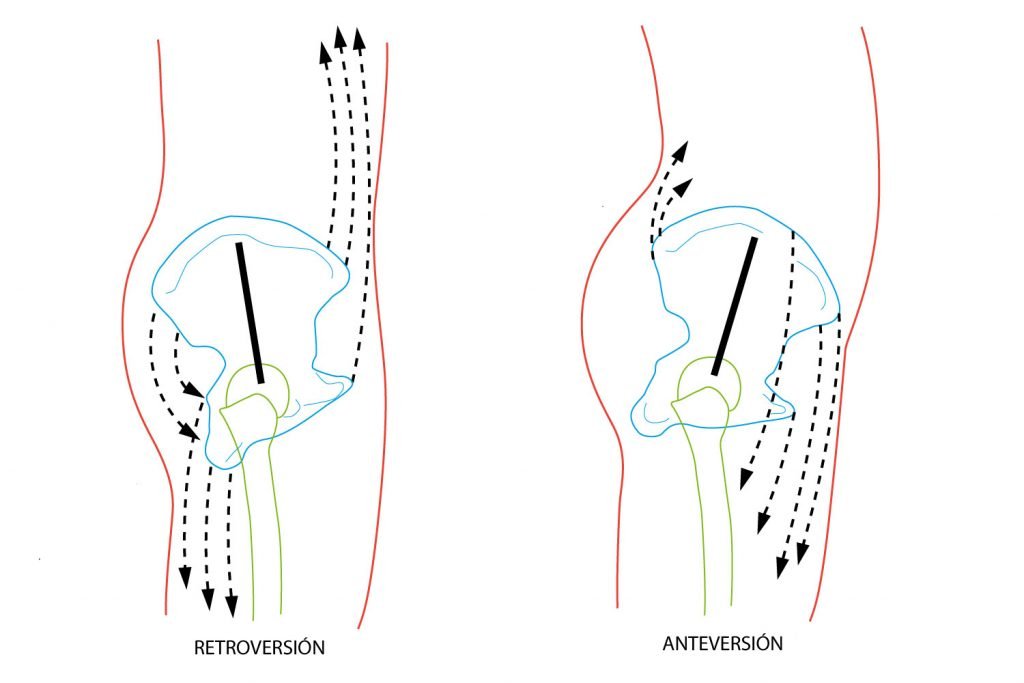 diastasis abdominal Multilaser