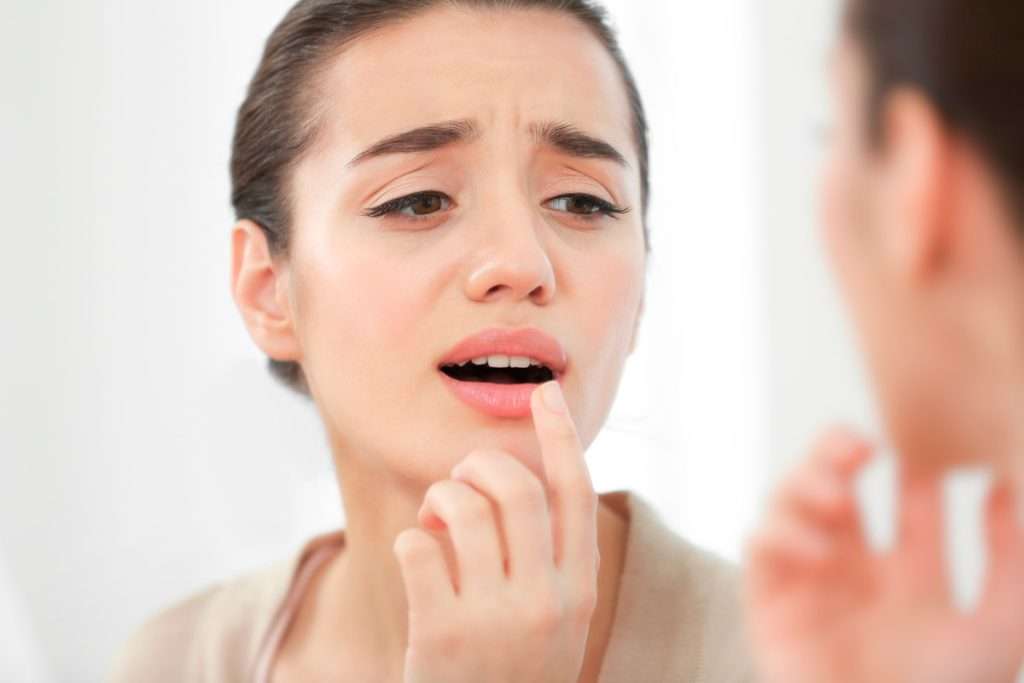 Tratamiento herpes labial lisina
